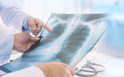 Aspiration Management in Outpatient GI Anesthesia: A Stepwise Approach for Anesthesia Providers